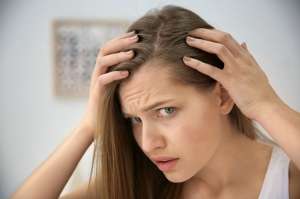 Front Hair Loss Female Remedy